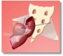 Consensus Anterior
